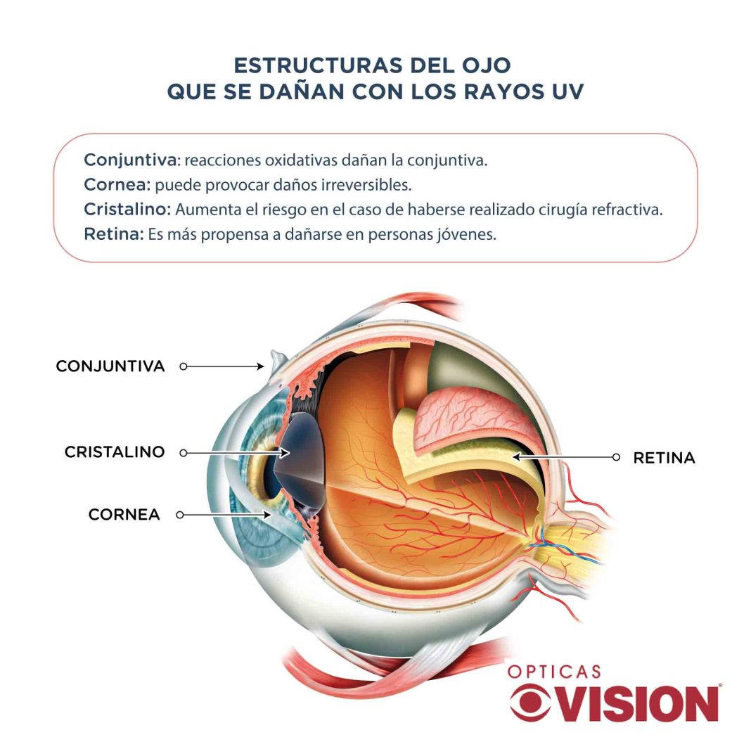 Infografía