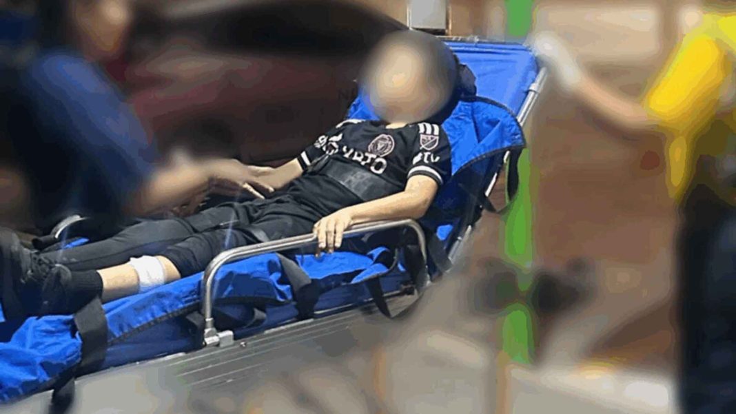 FOTO: Perro atacó y mordió a niño en Multiplaza Escazú