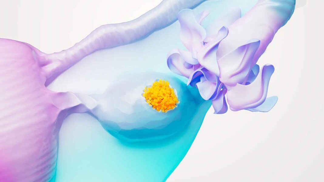 Concientización sobre los Cánceres Ginecológicos: Un llamado a salvar vidas a través de la detección temprana