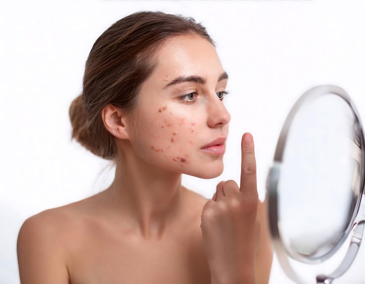 Reducir y prevenir las imperfecciones empieza por entender cómo funciona la piel