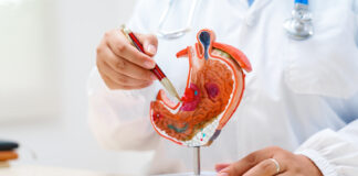 AstraZeneca amplía las alternativas de tratamiento para pacientes con cáncer gástrico
